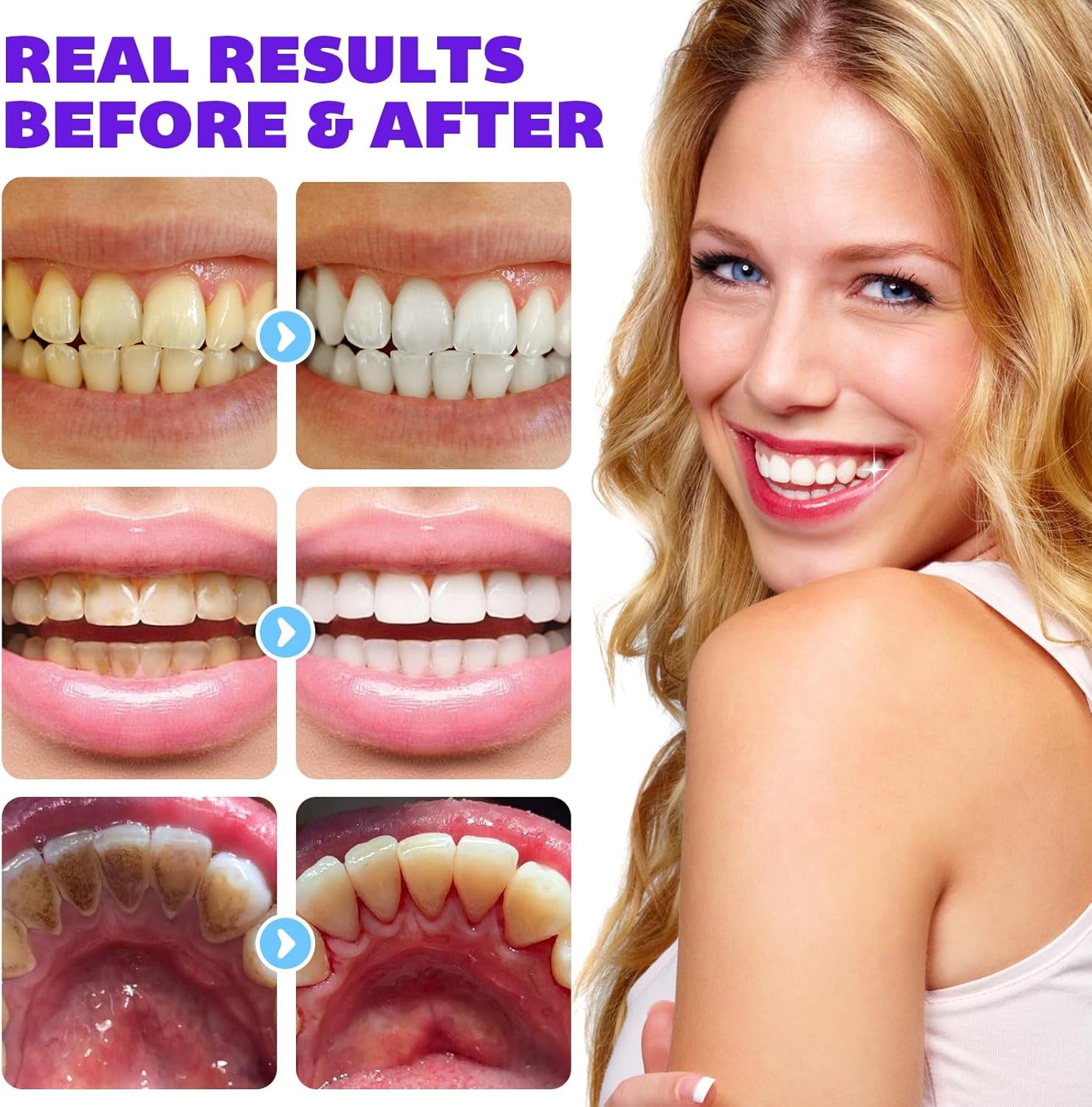 Toothpaste Tablets, Color Correcting Toothpaste Tablets with 5% Nano Hydroxyapatite - Fluoride Free, Teeth Whitening & Antiplaque, Chewable Toothpaste Tabs Strengthen Teeth 70Pcs